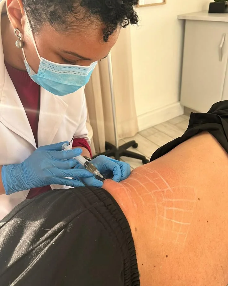 Fat Reduction Treatments in Surat
